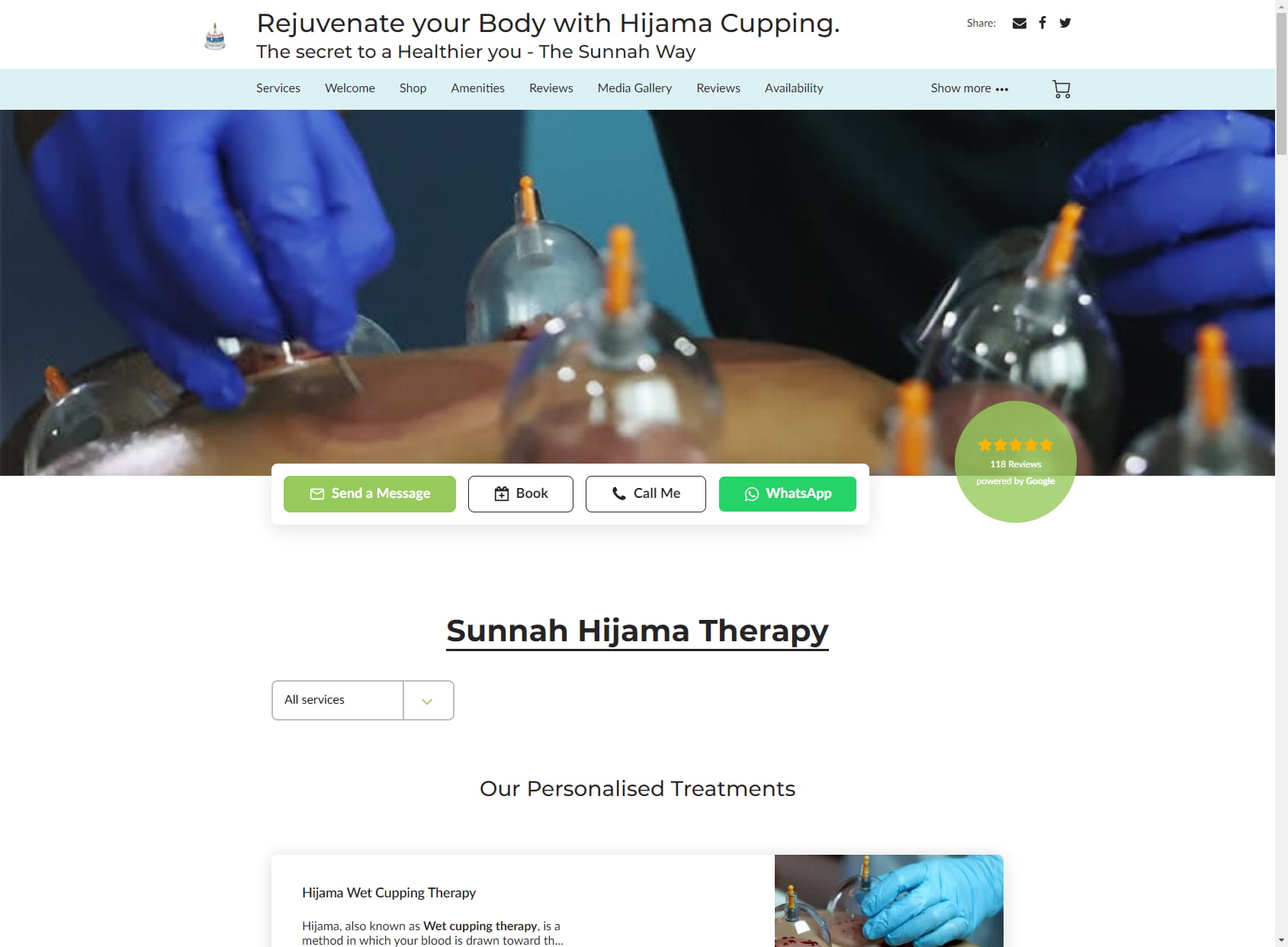 Sunnah Hijama